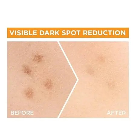Garnier Bright Complete 30X Vitamin C Booster Serum 15 ml | Lightweight Gel for Brightening & Spot Reduction Sellzoa