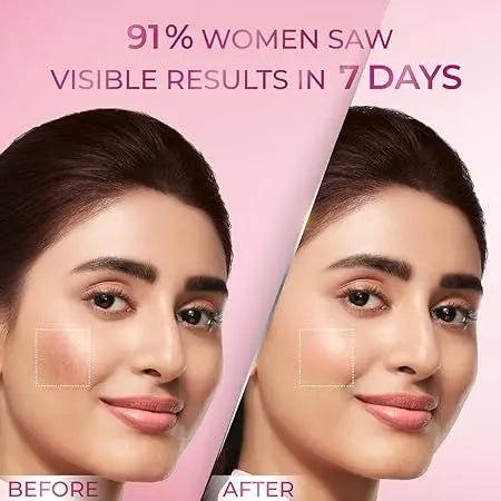 POND'S Anti-Pigmentation Serum 28ml | 12% Gluta-Niacinamide Complex | Reduces Pigmentation from Day 7 | Bright & Flawless Skin Sellzoa