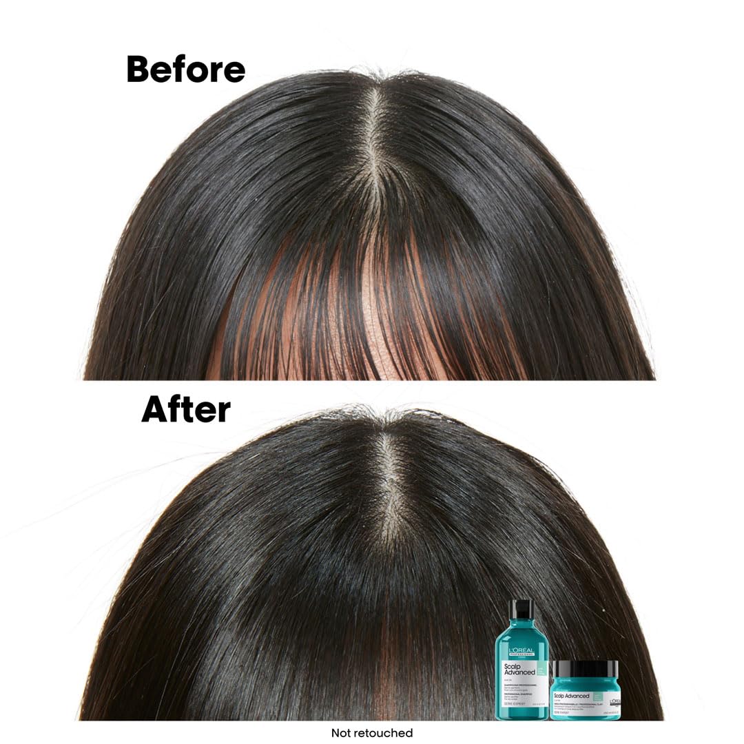 L'Oreal Professionnel Scalp Advanced Anti-Oiliness 2-In-1 Deep Purifier Clay | For Oily Scalp | With 3% AHA (250 Gm).