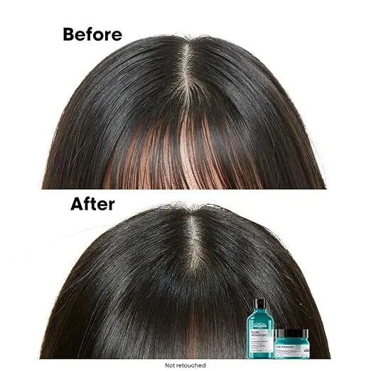 L'Oréal Scalp Advanced Anti-Oiliness Clay 250g | 2-in-1 Deep Purifier with 3% AHA | For Oily Scalp & Hair Detox Sellzoa