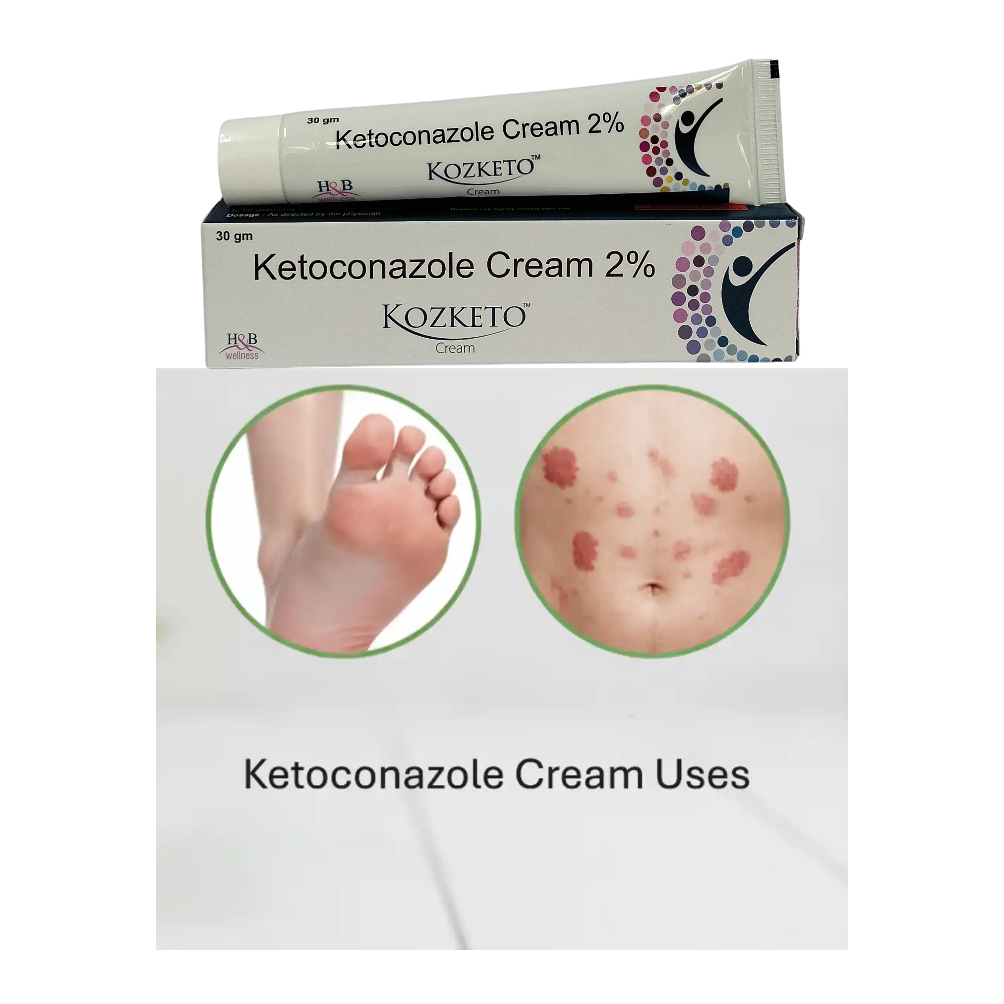 Kozketo cream 30gm pack of 2 with ketoconazole 2 percent for external skin use