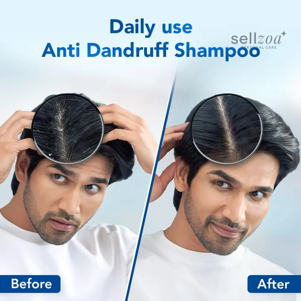 Scalpe Pro Daily Anti-Dandruff Shampoo Pack of 2 – - Health care